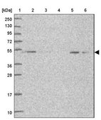 Anti-SNX6 antibody produced in rabbit Prestige Antibodies&#174; Powered by Atlas Antibodies, affinity isolated antibody, buffered aqueous glycerol solution