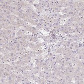 Anti-RAB9B antibody produced in rabbit Prestige Antibodies&#174; Powered by Atlas Antibodies, affinity isolated antibody, buffered aqueous glycerol solution