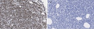 Anti-phospho-IRS1 (Tyr612) Antibody, clone 1N14, ZooMAb&#174; Rabbit Monoclonal recombinant, expressed in HEK 293 cells