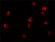 Anti-JMJD3 antibody produced in rabbit affinity isolated antibody