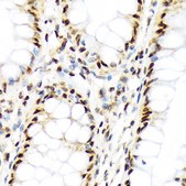 Anti-Histone H3 antibody produced in rabbit