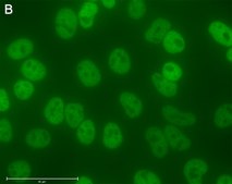 Anti-p-I&#954;B&#945;-Ser32 Antibody, clone 11D19 ZooMAb&#174; Rabbit Monoclonal recombinant, expressed in HEK 293 cells