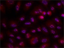 Anti-Coilin antibody, Mouse monoclonal ~1.5&#160;mg/mL, clone p&#948;, purified from hybridoma cell culture