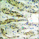 Anti-phospho-p53 (pThr18) antibody produced in rabbit affinity isolated antibody