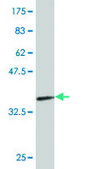 Monoclonal Anti-AGT antibody produced in mouse clone 1A10, purified immunoglobulin, buffered aqueous solution