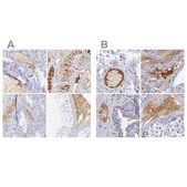 Anti-KNG1 antibody produced in rabbit Prestige Antibodies&#174; Powered by Atlas Antibodies, affinity isolated antibody, buffered aqueous glycerol solution