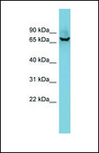 Anti-ACHE, (N-terminal) antibody produced in rabbit affinity isolated antibody