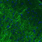 Monoclonal Anti-NEFM antibody produced in mouse Prestige Antibodies&#174; Powered by Atlas Antibodies, clone CL2697, purified immunoglobulin, buffered aqueous glycerol solution