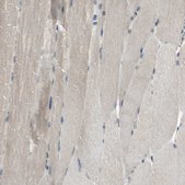 Anti-SYVN1 antibody produced in rabbit Prestige Antibodies&#174; Powered by Atlas Antibodies, affinity isolated antibody, buffered aqueous glycerol solution