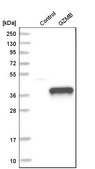 Anti-GZMB antibody produced in rabbit Prestige Antibodies&#174; Powered by Atlas Antibodies, affinity isolated antibody, buffered aqueous glycerol solution