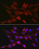 Anti-PGD Antibody, clone 9A2M7, Rabbit Monoclonal
