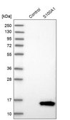 Anti-S100A1 antibody produced in rabbit Prestige Antibodies&#174; Powered by Atlas Antibodies, affinity isolated antibody, buffered aqueous glycerol solution