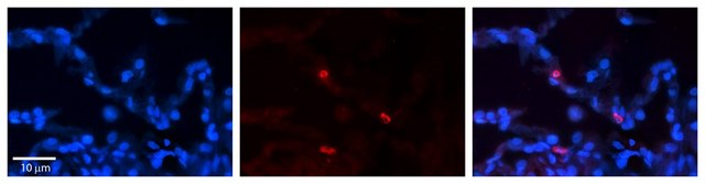 Anti-FCGRT affinity isolated antibody