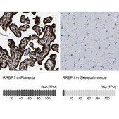 Anti-RRBP1 antibody produced in rabbit Prestige Antibodies&#174; Powered by Atlas Antibodies, affinity isolated antibody, buffered aqueous glycerol solution