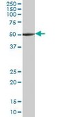 Monoclonal Anti-TUBA3, (C-terminal) antibody produced in mouse clone 2D2, purified immunoglobulin, buffered aqueous solution