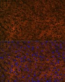 Anti-CPS1 antibody produced in rabbit