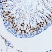 Anti-DDIT3/CHOP antibody produced in rabbit