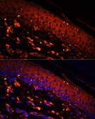 Anti-FSCN1 antibody produced in rabbit
