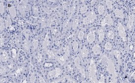Anti-KRas Antibody, clone 2J13, ZooMAb® Rabbit Monoclonal recombinant, expressed in HEK 293 cells