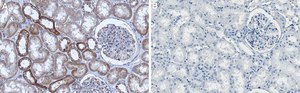 Anti-PI-3 kinase p110&#945; Antibody, clone 1J4 ZooMAb&#174; Rabbit Monoclonal recombinant, expressed in HEK 293 cells