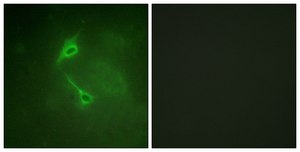 Anti-PKC &#950; antibody produced in rabbit affinity isolated antibody