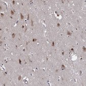 Anti-PSMD4 antibody produced in rabbit Prestige Antibodies&#174; Powered by Atlas Antibodies, affinity isolated antibody, buffered aqueous glycerol solution