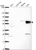 Anti-Ces2 Antibody Produced In Rabbit Prestige Antibodies&#174; Powered by Atlas Antibodies, affinity isolated antibody, buffered aqueous glycerol solution