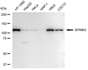 KD-Validated Anti SPINK5 Antibody, clone 23GB4180, Rabbit Monoclonal clone 23GB4180, recombinant rabbit monoclonal, expressed in HEK293 cells