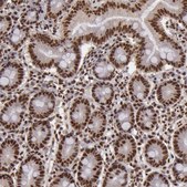 Anti-SP1 antibody produced in rabbit Ab1, Prestige Antibodies&#174; Powered by Atlas Antibodies, affinity isolated antibody, buffered aqueous glycerol solution