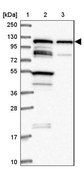 Anti-TBC1D2B antibody produced in rabbit Prestige Antibodies&#174; Powered by Atlas Antibodies, affinity isolated antibody, buffered aqueous glycerol solution