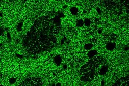 Anti-Glutamate Transporter Antibody, Glial serum, Chemicon&#174;
