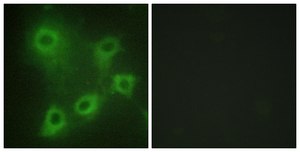 Anti-SYK antibody produced in rabbit affinity isolated antibody