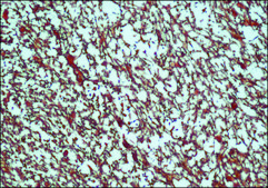 Anti-S-100 antibody produced in rabbit IgG fraction of antiserum, buffered aqueous solution