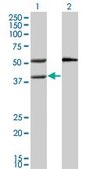 Monoclonal Anti-MVK, (C-terminal) antibody produced in mouse clone 2C5, purified immunoglobulin, buffered aqueous solution