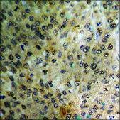 Anti-phospho-XIAP (pSer87) antibody produced in rabbit affinity isolated antibody