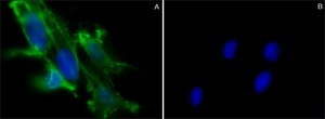 Cholera Toxin B subunit recombinant, expressed in HEK 293 cells, subunit A free