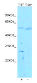 Anti-TNAIP6 (C-terminal) antibody produced in rabbit affinity isolated antibody