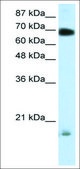 Anti-TRIM32 antibody produced in rabbit affinity isolated antibody