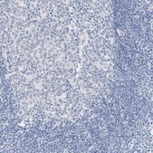 Anti-SLC22A13 antibody produced in rabbit Prestige Antibodies&#174; Powered by Atlas Antibodies, affinity isolated antibody, buffered aqueous glycerol solution
