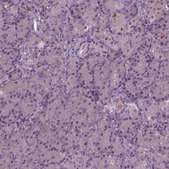 Anti-PORCN antibody produced in rabbit Prestige Antibodies&#174; Powered by Atlas Antibodies, affinity isolated antibody
