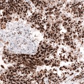 Monoclonal Anti-Msh2 Antibody Produced In Mouse Prestige Antibodies&#174; Powered by Atlas Antibodies, clone CL13724, affinity isolated antibody, buffered aqueous glycerol solution