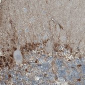 Monoclonal Anti-PHGDH antibody produced in mouse Prestige Antibodies&#174; Powered by Atlas Antibodies, clone CL0555, purified immunoglobulin, buffered aqueous glycerol solution