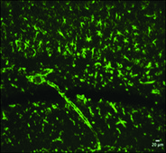 Anti-Nestin antibody produced in rabbit ~1&#160;mg/mL, affinity isolated antibody, buffered aqueous solution