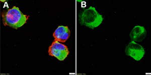 Anti-PLVAP Antibody, clone 3K18 ZooMAb&#174; Rabbit Monoclonal recombinant, expressed in HEK 293 cells