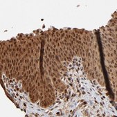 Anti-CASP1 antibody produced in rabbit Prestige Antibodies&#174; Powered by Atlas Antibodies, affinity isolated antibody, buffered aqueous glycerol solution