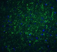 Anti-PDL-2 antibody produced in rabbit affinity isolated antibody, buffered aqueous solution