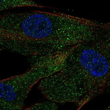 Anti-ACE antibody produced in rabbit Prestige Antibodies&#174; Powered by Atlas Antibodies, affinity isolated antibody