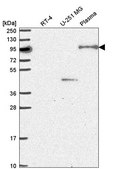 Anti-NOM1 antibody produced in rabbit Prestige Antibodies&#174; Powered by Atlas Antibodies, affinity isolated antibody