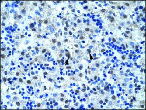 Anti-CDC25B (AB2) antibody produced in rabbit affinity isolated antibody