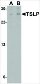 Anti-TSLP (ab1) antibody produced in rabbit affinity isolated antibody, buffered aqueous solution